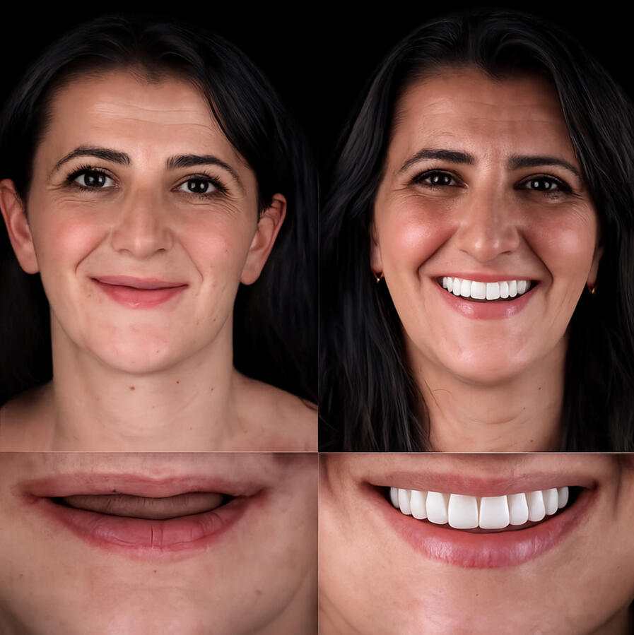 Pacjentka Perła Smile - Szczecin, Listopad 2025 Pacjentka Perła Smile - Szczecin, Listopad 2025